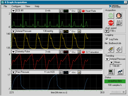 LabVIEW